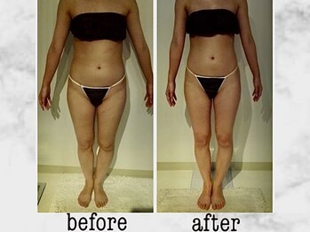 ナチュラーレ 京都四条烏丸店(Naturale)/リンパマッサージ痩身ダイエット