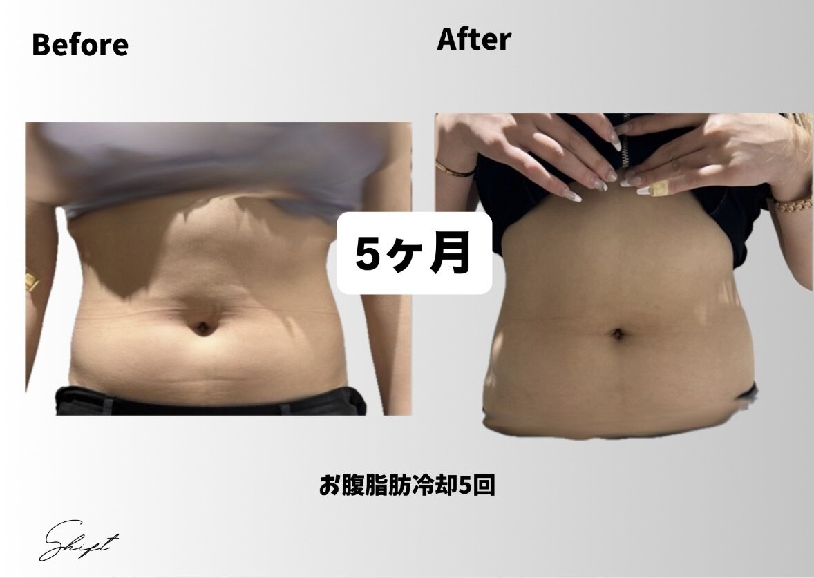 シフト 原宿店(SHIFT)｜ホットペッパービューティー