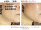 シャンス(CHANCE)の写真