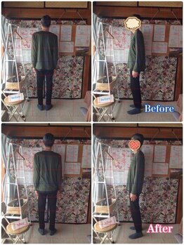 いとう整体院/長年、腕が上がらなかった