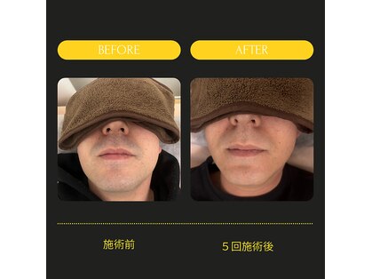 ラポール(Rapport)の写真