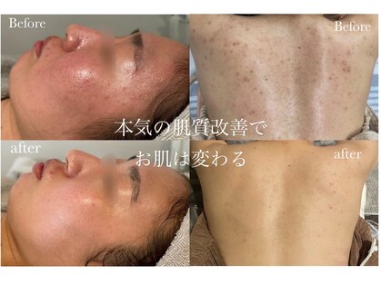 ミコル(micoru)の写真