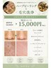 【毛穴肌質改善エステ】毛穴エクストラクションプロ&ハーブピーリング