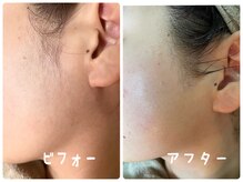 マル(maru)の雰囲気(古い角質産毛除去でツヤ肌♪お顔剃り/シェービング/ブライダル)