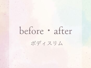 ボディスリム/お客様のBefore・After
