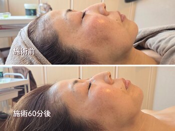 オラ(Ola)/40代/60分後