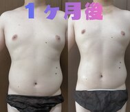 痩身 脱毛専門サロン 椿