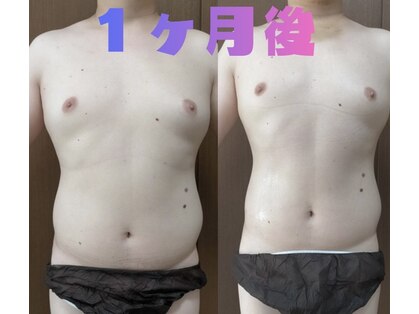 痩身 脱毛専門サロン 椿の写真