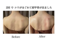 ナチュラーレ 天王寺店(Naturale)/痩身リンパマッサージ二の腕美脚