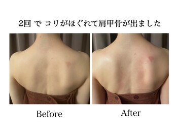 ナチュラーレ 天王寺店(Naturale)/痩身リンパマッサージ二の腕美脚