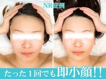 ソウルスキン