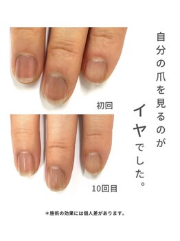 最強ネイルケア