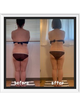 ソワン(soin)/お腹&腰まわり集中ケア