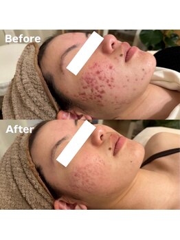 ラティア(Ratia)/