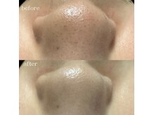 リメレ(Rimere)の雰囲気（40種類以上の美容液で毛穴を洗浄！同時に美容成分をお肌に導入！）
