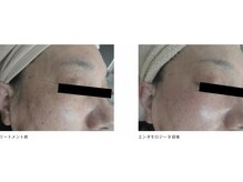 ミロク 伏見桃山店(miroku)/エンダフェイシャル