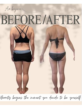 エイエービジュー(Aa.bijou)/