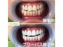 ルブラン 奈良店(Le Blanc)/綺麗な歯の方が魅力的！
