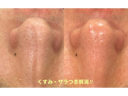 ツール(TOOL)の写真