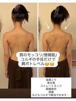 パル コルギサロン(Pal. Korugi salon)/コルギビフォーアフター