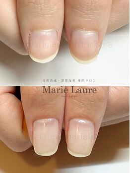 マリーロール 天王寺店(Marie Laure)/深爪矯正/自爪育成/ネイルケア