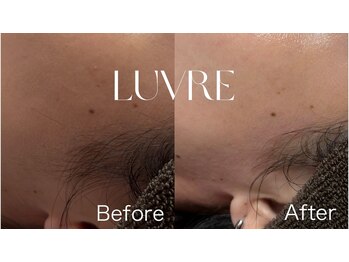 ルーヴレ(LUVRE)/フェイシャルWAX