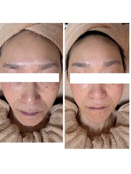 越前屋/TGFエッセンス