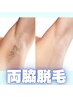 【何度でも使える♪】　両ワキ脱毛　1回　1,650円
