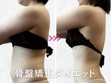 美容整体カラダリメイク(karada)の雰囲気（【骨盤矯正×ラジオ波施術】自力では難しい頑固な脂肪も撃退！）