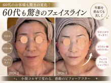 リベラ(Re:BELLA)の雰囲気（60代も驚きのフェイスライン！たるみケア実績多数◎）