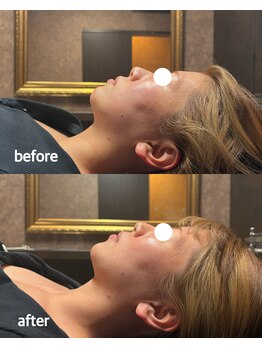 アスティ(ASTY)の写真/小顔と脂肪のケアで理想の自分へ！ご褒美メニューで心も弾む贅沢な体験を♪お顔だけでなく身体の施術も◎