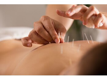 いちかわレディース鍼灸院/鍼灸と一緒にオイルマッサージ