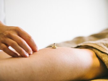 アキュネ 福岡薬院店(acune)/福岡/薬院/美容鍼/美肌