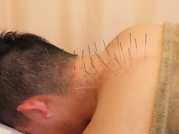 リサ鍼灸院(RISA鍼灸院)/ルート鍼/