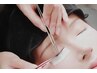 （パッチテスト）無料カウンセリング