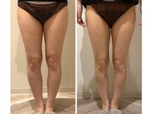 エイシスグロウ(asis glow.)/効果写真