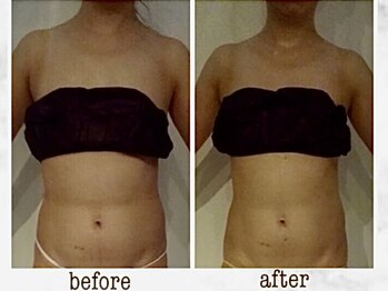 ナチュラーレ 京都四条烏丸店(Naturale)/リンパマッサージ痩身ダイエット