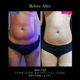 アディクト(Addict)