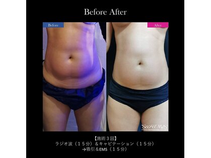 アディクト(Addict)の写真