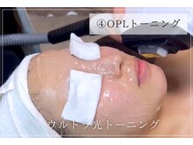 ボータン 恵(Beau Temps)/4.OPLトーニング/光フォト