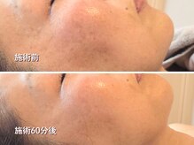 オラ(Ola)/40代/60分後