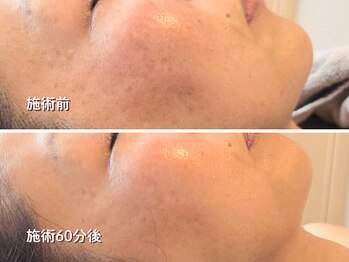 オラ(Ola)/40代/60分後