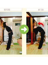 サプライズ整体院/20代ママさんの腰痛初回結果