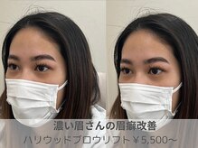 リモア(REMORE)/HBL【ハリウッドブロウリフト】