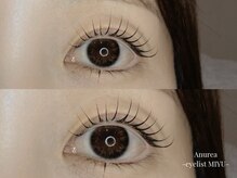 アニュレア バイ レヴィエリス(Anurea by Re’VIELISS)/ラッシュリフト