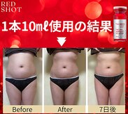 ニュイブラーシュ(nuit blanche)