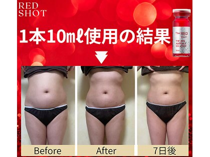 ニュイブラーシュ(nuit blanche)の写真