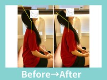 こころ整骨院/２0代女性のビフォーアフター