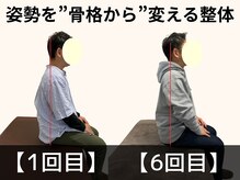 パルマ なかもず(Palma)/整体/頭痛/肩こり/ヘッドスパ