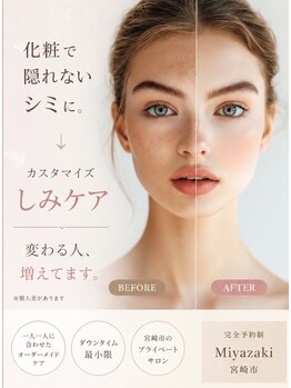 クラージュの写真/お化粧で隠せなくなったシミでお悩みの方に！1人1人に合うシミケアをご提案♪皆がやってる光フェイシャル★